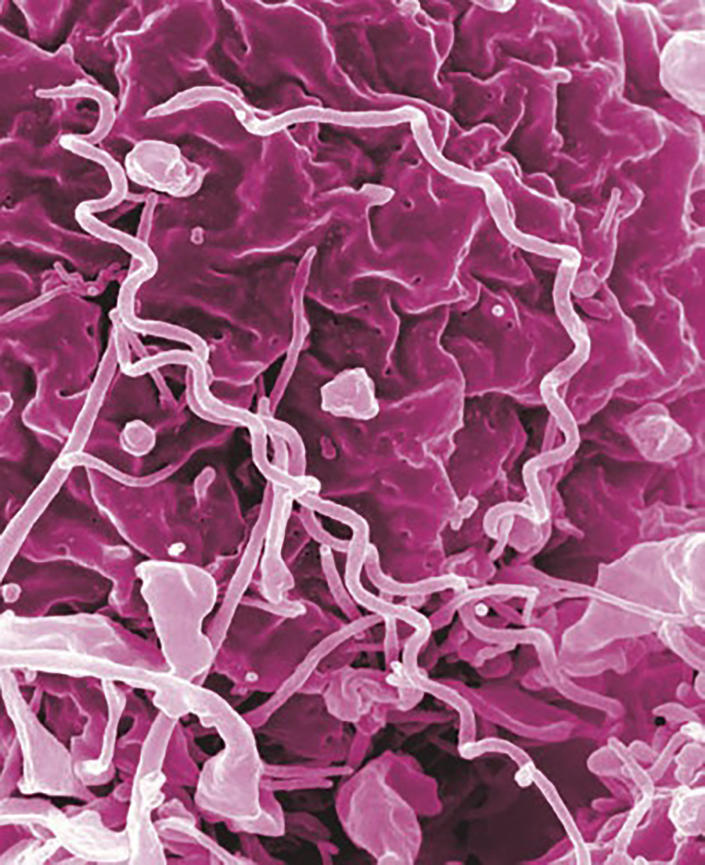 In an undated image from the National Institute of Allergy and Infectious Diseases, treponema pallidum, the bacterium that causes syphilis.  (NIAID via The New York Times)