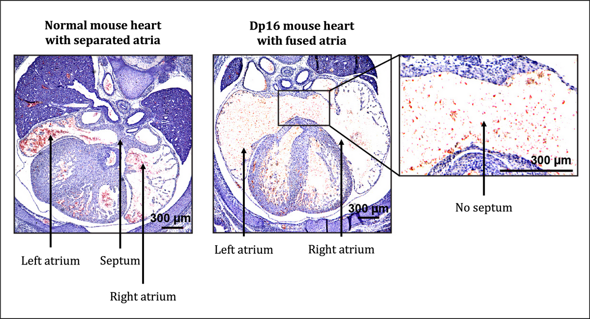 Cross sections of mouse hearts with and without atrial septa.